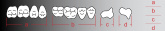 Планки четырехслойных зубов REF-LINE, жеват., низ